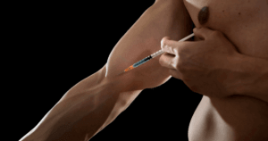 Injecting Steroids