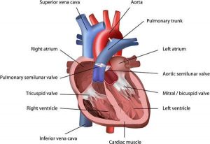 pulmonary-atresia