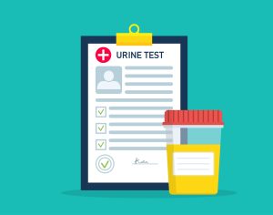 DUI urine testing